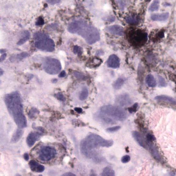Stacks Image 383